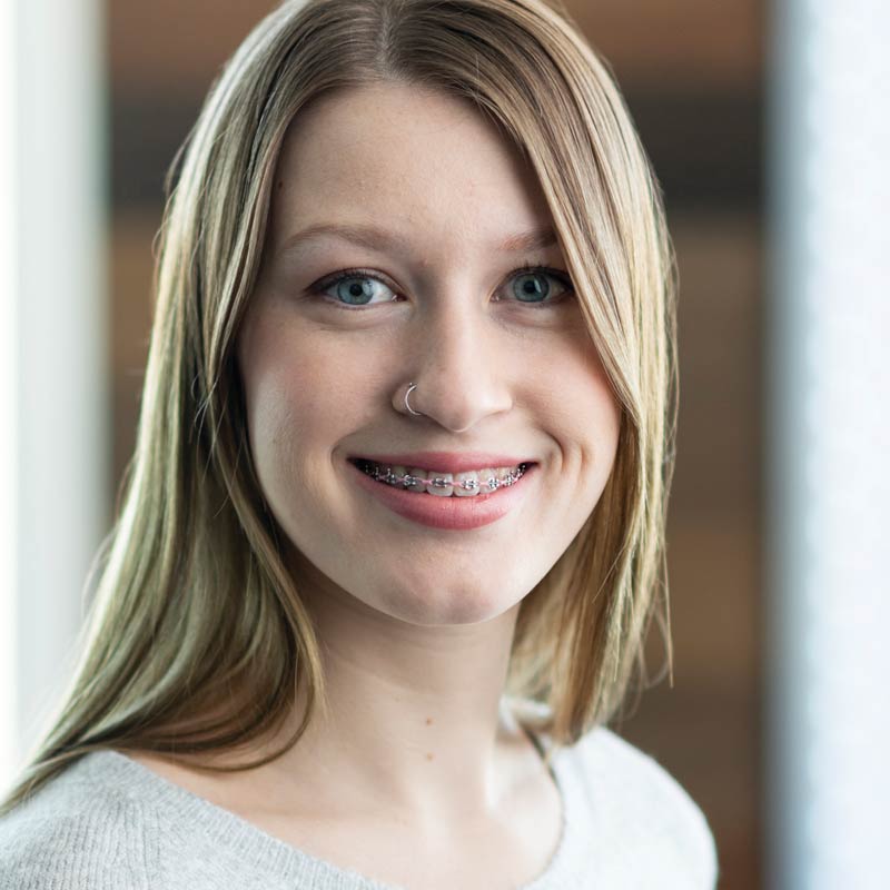Orthodontics-Image-800px-2