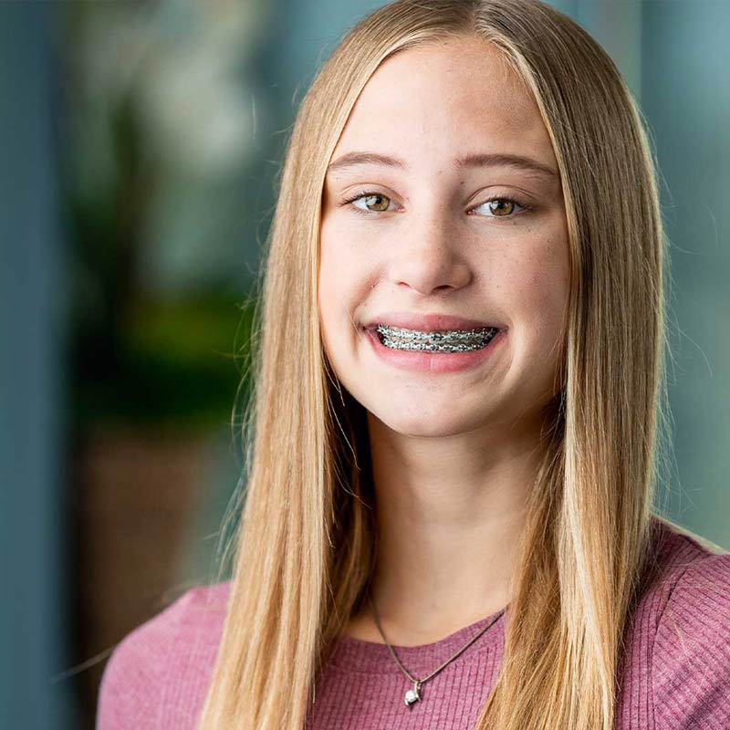 Early Treatment - Prairie Pointe Orthodontics